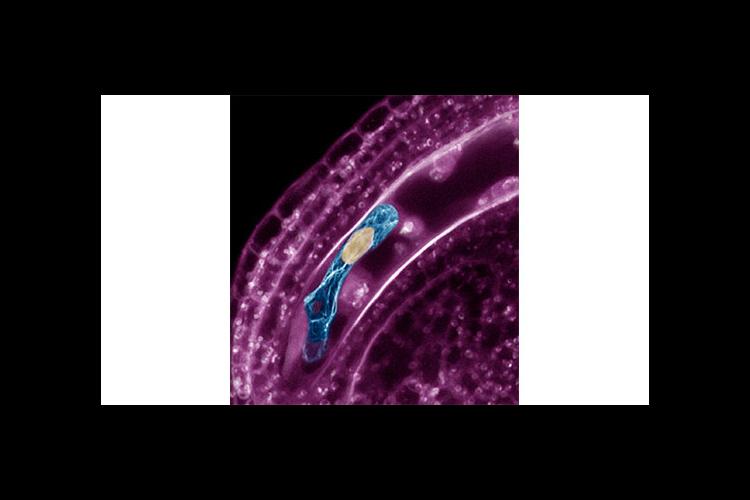 This image of a fertilized Arabidopsis egg cell shows the cell elongation with actin filaments in blue and nucleus in yellow. 