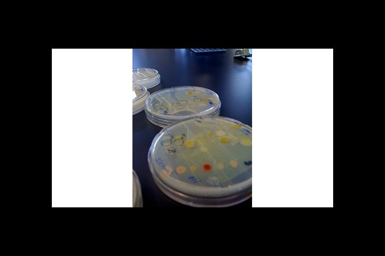 Bacteria growing in the Moe lab 