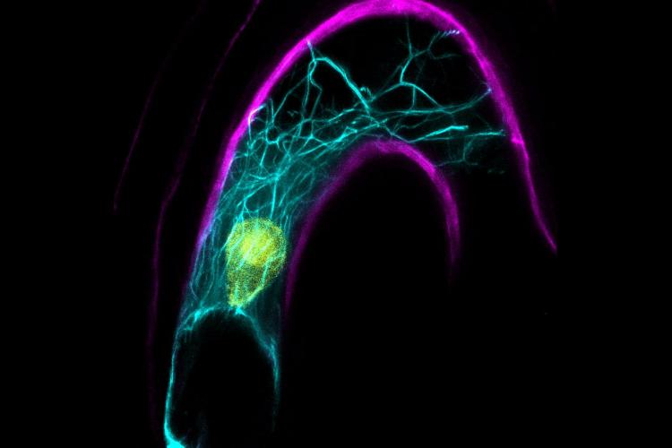 A confocal microscope image of the Arabidopsis female cell including the nucleus in yellow and intracellular cables which help with sperm nucleus migration upon fertilization. The cell wall is pictured in magenta. Photo courtesy of Tomokazu Kawashima. 