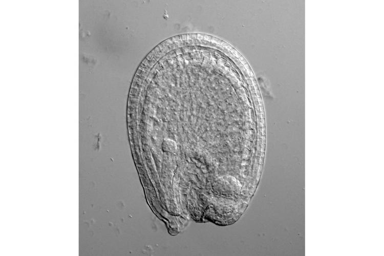 A tiny, spherical embryo, on the left side of the image, grows inside the endosperm of a young Arabidopsis seed. Photo by Mohammad Foteh Ali, graduate student in Kawashima's lab.