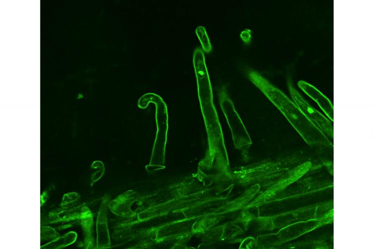 Successful interactions between soybeans and nitrogen-fixing bacteria result in the curling of root hairs, pictured here, which eventually turn into nodules that allow the legumes to fix nitrogen. Photo courtesy of Aarda Kachroo, UK plant pathologist.